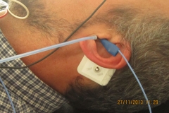 Electrococleografia-potenciales-evocados-auditivos